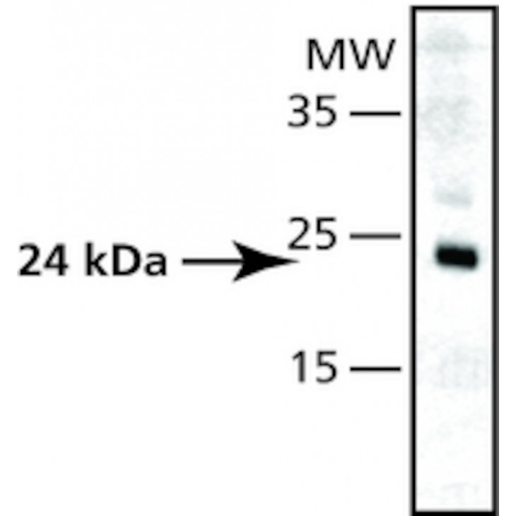 ANTI-SUPEROXIDE DISMUTASE SIGMA S5069-200UL