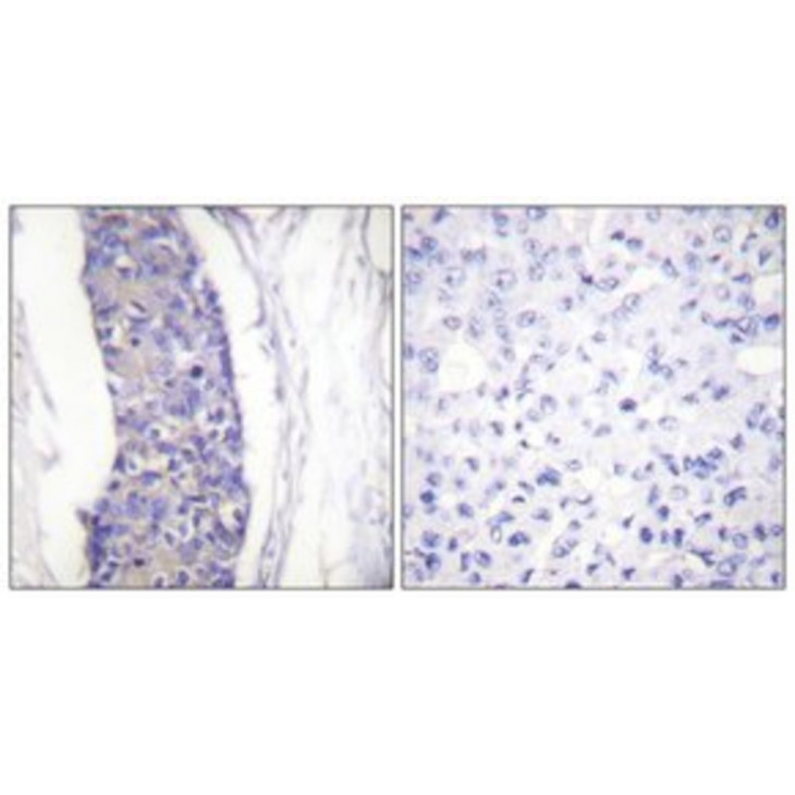 ANTI-TUBULIN ALPHA - SIGMA SAB4500087