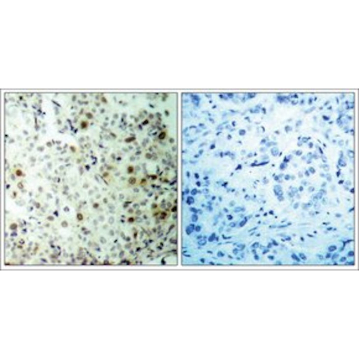 ANTI-PHOSPHO CDK2 (THR 160) SIGMA SAB4300110-100UG