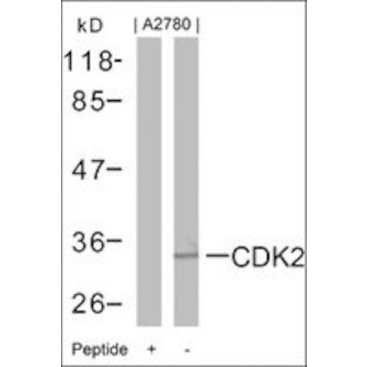 ANTI-CDK2 (AB-160) SIGMA SAB4300388-100UG