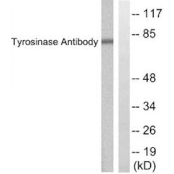 ANTI-TYROSINASE SIGMA SAB4503051-100UG