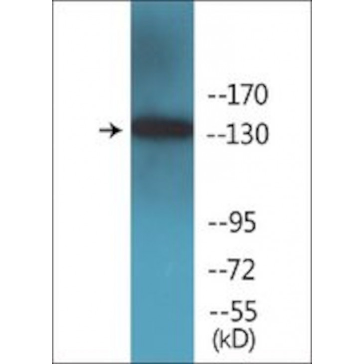 ANTI-PHOSPHO-IRS-1 (PSER1101) SIGMA SAB4503887-100UG