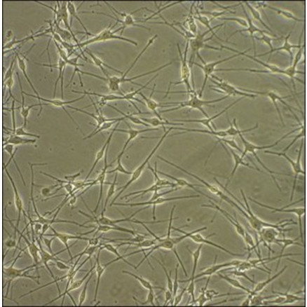 HUMAN EPIDERMAL MELANOCYTES SIGMA 104-05A