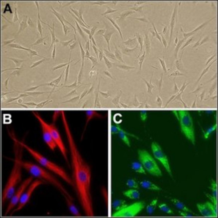 HUMAN DERMAL FIBROBLASTS SIGMA 106-05A