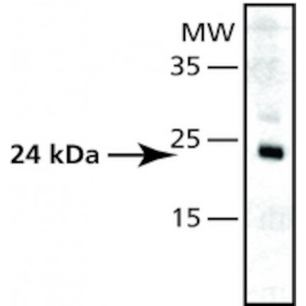 ANTI-SUPEROXIDE DISMUTASE SIGMA S5069-200UL