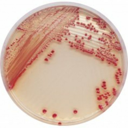 CHROMAGAR ACINETOBACTER QSP 5L