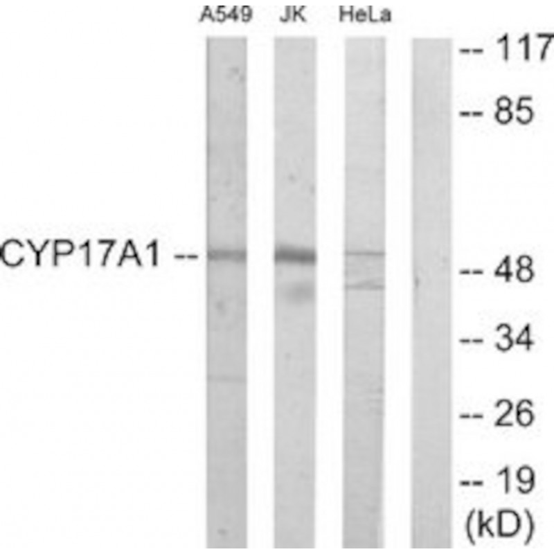ANTI-CYTOCHROME P450 17A1 SIGMA SAB4500604 - 100 UG