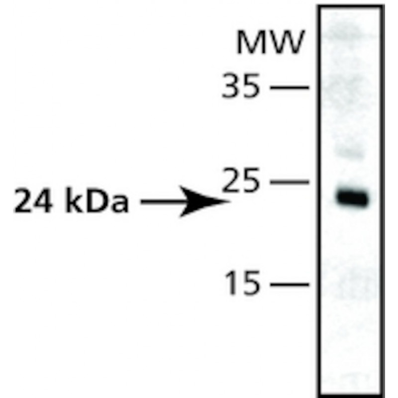 ANTI-SUPEROXIDE DISMUTASE SIGMA S5069-200UL
