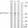 ANTI-CYTOCHROME P450 17A1 SIGMA SAB4500604 - 100 UG